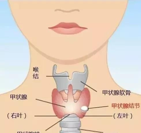 桥本氏甲状腺炎如何治疗以及需要服用那些药？