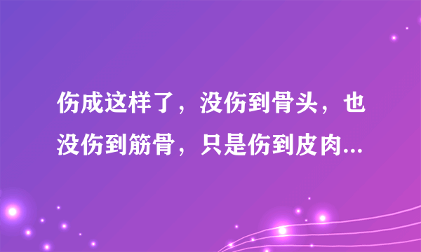 伤成这样了，没伤到骨头，也没伤到筋骨，只是伤到皮肉和一点青筋，还会好吗？