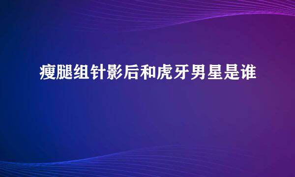 瘦腿组针影后和虎牙男星是谁