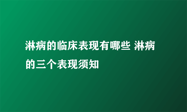 淋病的临床表现有哪些 淋病的三个表现须知