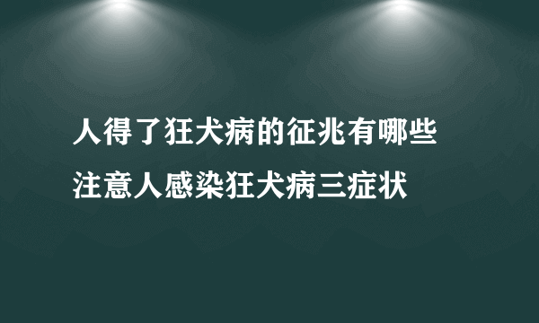 人得了狂犬病的征兆有哪些 注意人感染狂犬病三症状