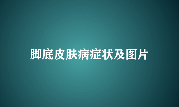 脚底皮肤病症状及图片