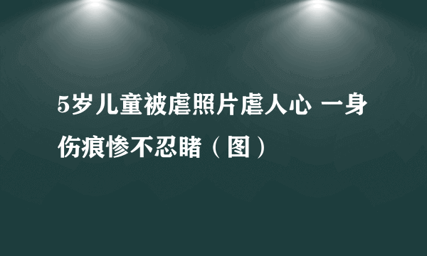 5岁儿童被虐照片虐人心 一身伤痕惨不忍睹（图）