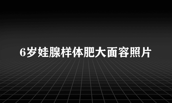 6岁娃腺样体肥大面容照片