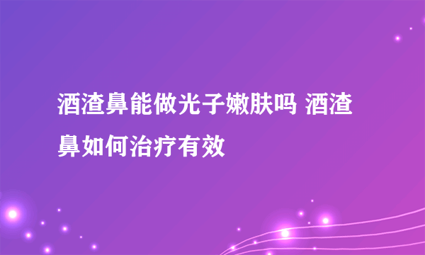 酒渣鼻能做光子嫩肤吗 酒渣鼻如何治疗有效