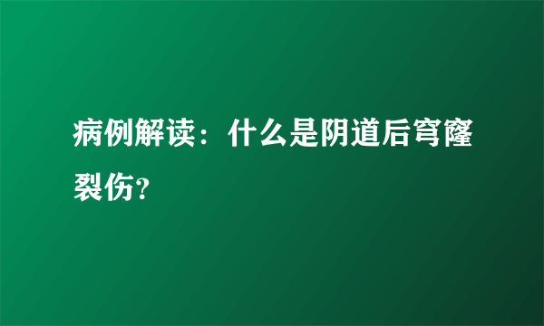 病例解读：什么是阴道后穹窿裂伤？