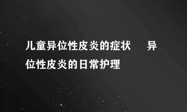 儿童异位性皮炎的症状     异位性皮炎的日常护理