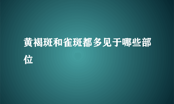 黄褐斑和雀斑都多见于哪些部位