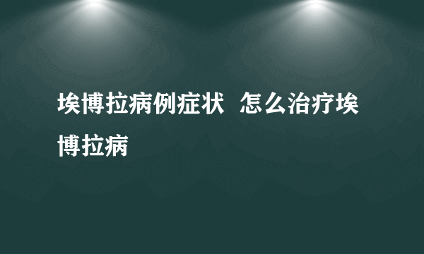 埃博拉病例症状  怎么治疗埃博拉病