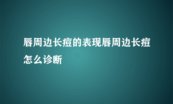 唇周边长痘的表现唇周边长痘怎么诊断