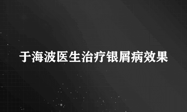 于海波医生治疗银屑病效果