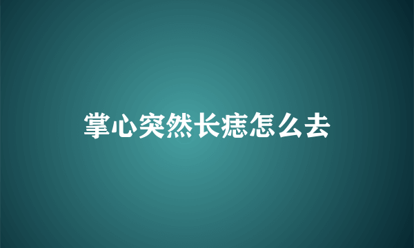 掌心突然长痣怎么去