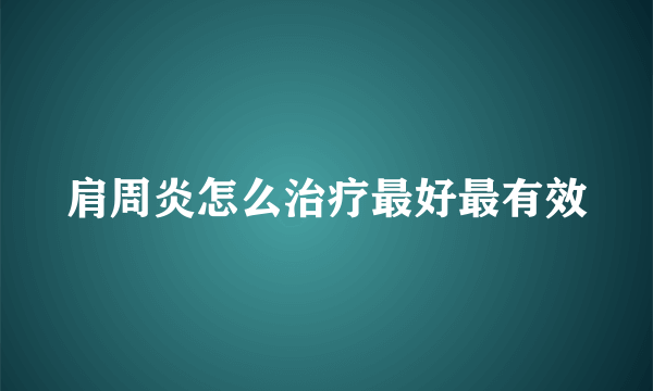 肩周炎怎么治疗最好最有效