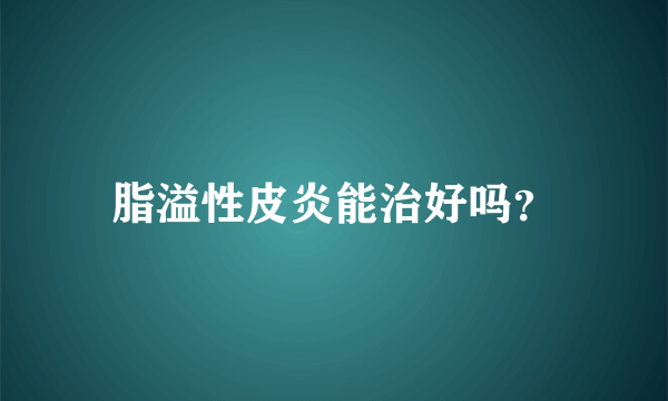 脂溢性皮炎能治好吗？