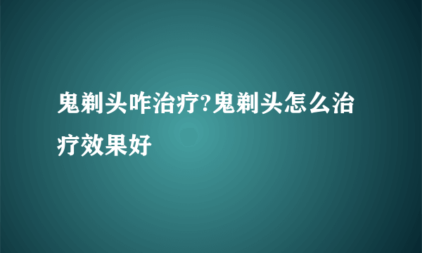 鬼剃头咋治疗?鬼剃头怎么治疗效果好