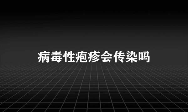 病毒性疱疹会传染吗