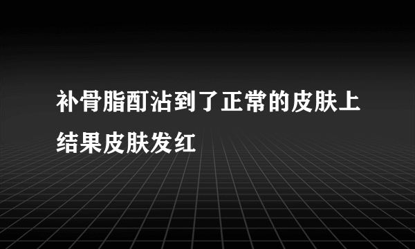 补骨脂酊沾到了正常的皮肤上结果皮肤发红