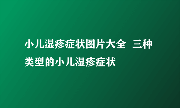 小儿湿疹症状图片大全  三种类型的小儿湿疹症状