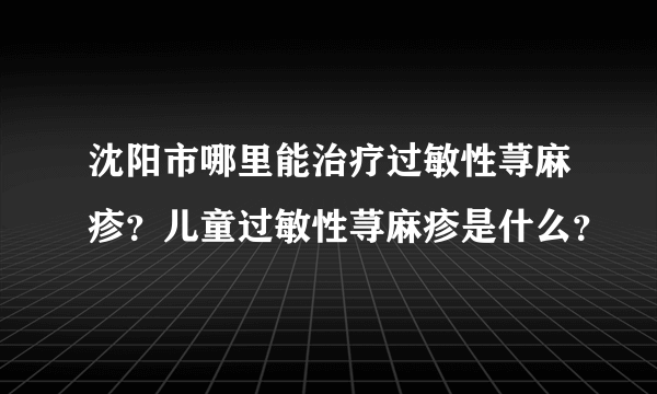 沈阳市哪里能治疗过敏性荨麻疹？儿童过敏性荨麻疹是什么？