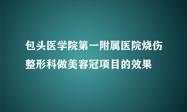 包头医学院第一附属医院烧伤整形科做美容冠项目的效果