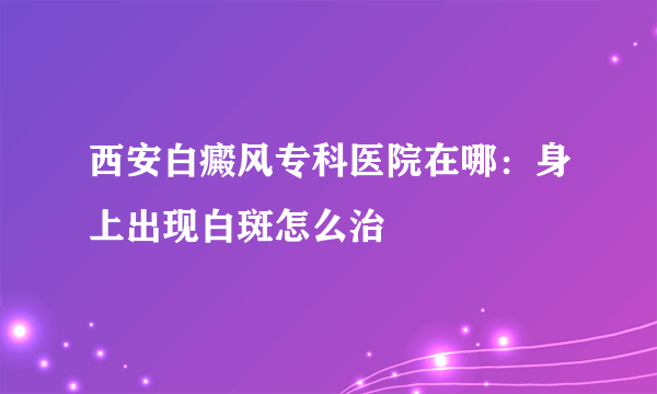 西安白癜风专科医院在哪：身上出现白斑怎么治