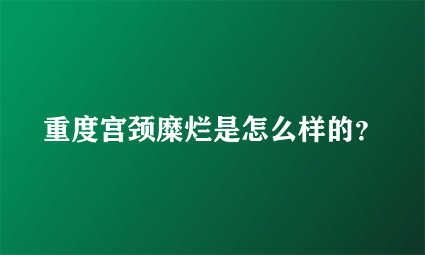 重度宫颈糜烂是怎么样的？