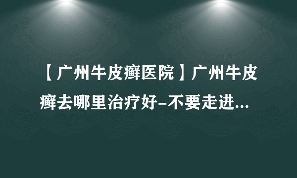 【广州牛皮癣医院】广州牛皮癣去哪里治疗好-不要走进牛皮癣治疗中的误区