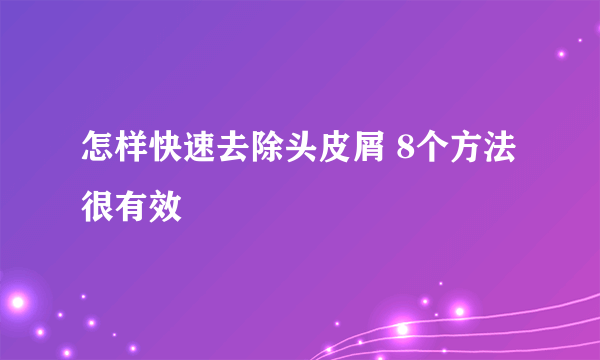 怎样快速去除头皮屑 8个方法很有效