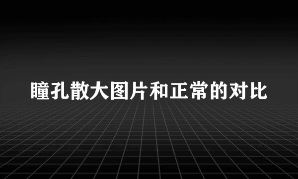 瞳孔散大图片和正常的对比