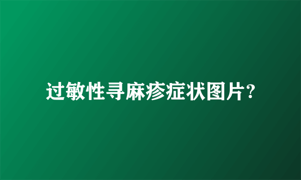 过敏性寻麻疹症状图片?