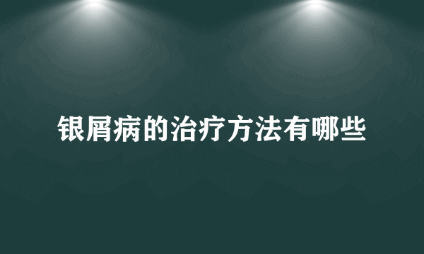 银屑病的治疗方法有哪些