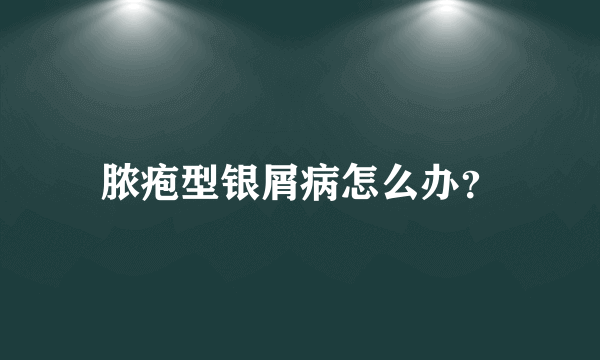 脓疱型银屑病怎么办？