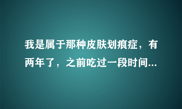 我是属于那种皮肤划痕症，有两年了，之前吃过一段时间...