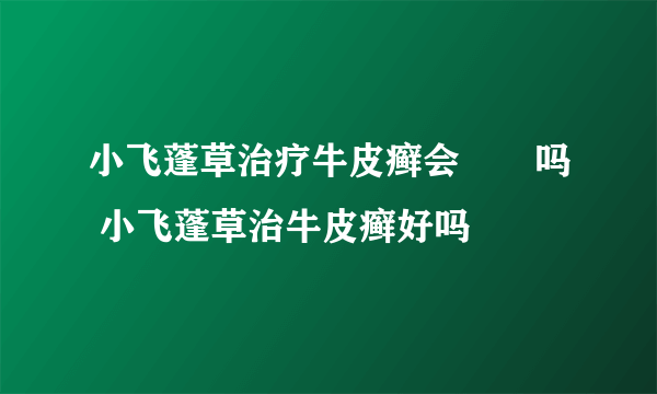 小飞蓬草治疗牛皮癣会復發吗 小飞蓬草治牛皮癣好吗