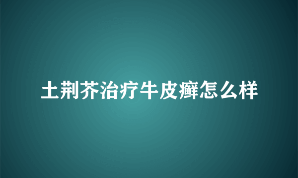 土荆芥治疗牛皮癣怎么样