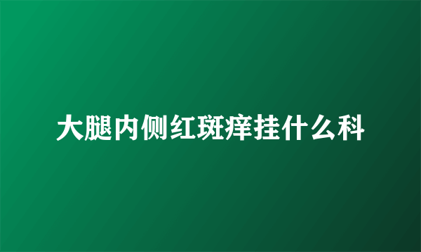 大腿内侧红斑痒挂什么科