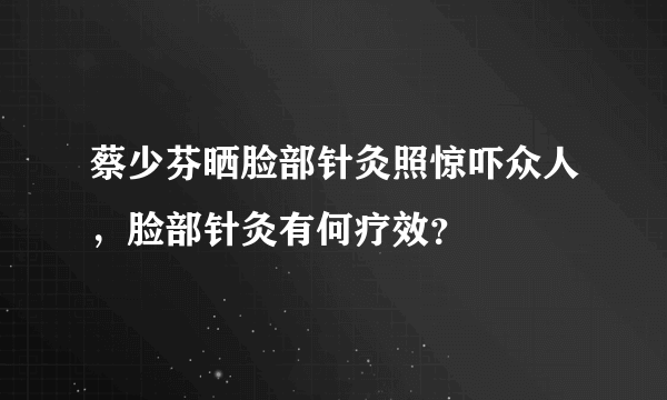 蔡少芬晒脸部针灸照惊吓众人，脸部针灸有何疗效？