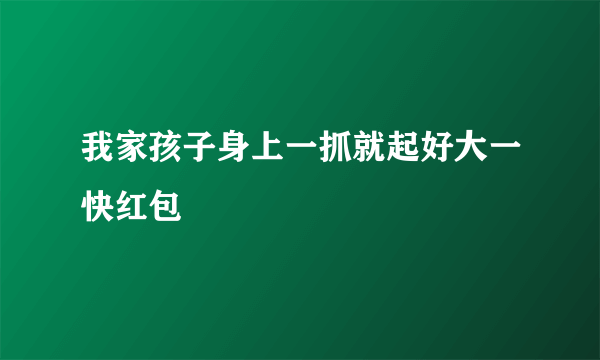 我家孩子身上一抓就起好大一快红包