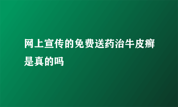 网上宣传的免费送药治牛皮癣是真的吗