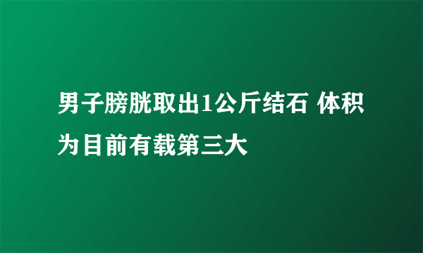 男子膀胱取出1公斤结石 体积为目前有载第三大