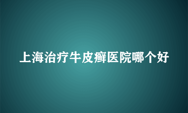 上海治疗牛皮癣医院哪个好