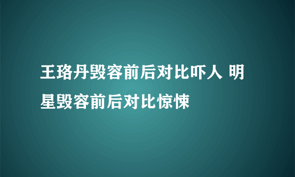 王珞丹毁容前后对比吓人 明星毁容前后对比惊悚