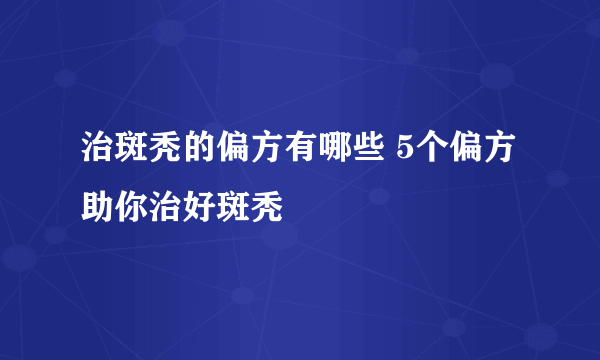 治斑秃的偏方有哪些 5个偏方助你治好斑秃