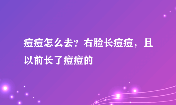 痘痘怎么去？右脸长痘痘，且以前长了痘痘的