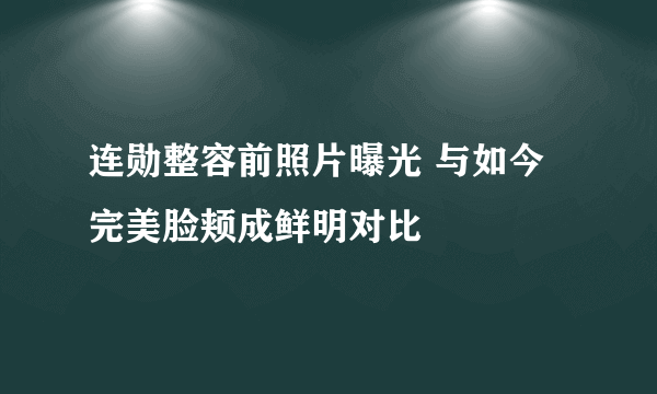 连勋整容前照片曝光 与如今完美脸颊成鲜明对比