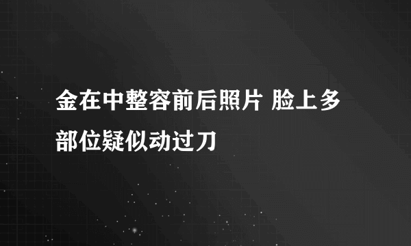 金在中整容前后照片 脸上多部位疑似动过刀