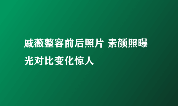 戚薇整容前后照片 素颜照曝光对比变化惊人