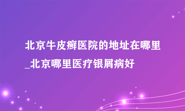 北京牛皮癣医院的地址在哪里_北京哪里医疗银屑病好