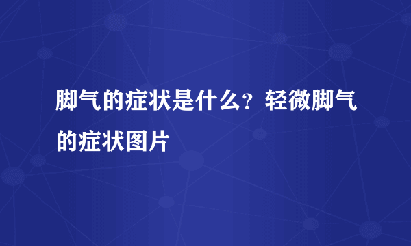 脚气的症状是什么？轻微脚气的症状图片