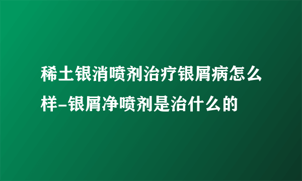 稀土银消喷剂治疗银屑病怎么样-银屑净喷剂是治什么的